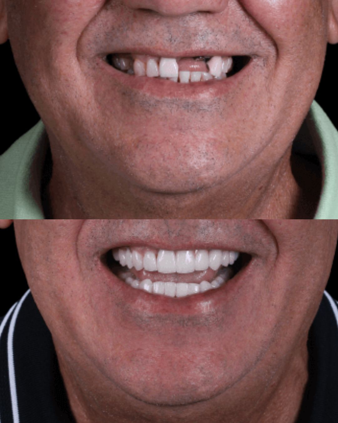 Sorriso natural após tratamento odontológico